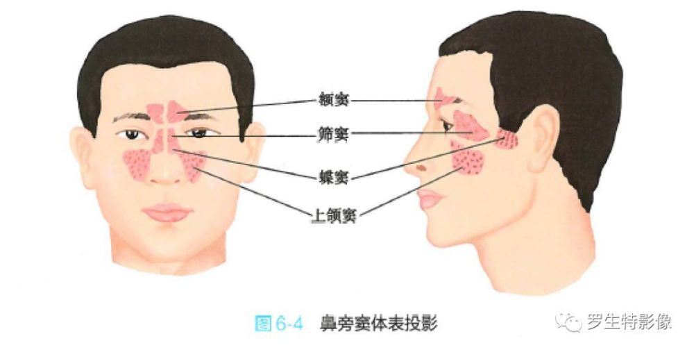 上颌窦maxillary sinu,位于上颌骨体内,呈三角锥体形.