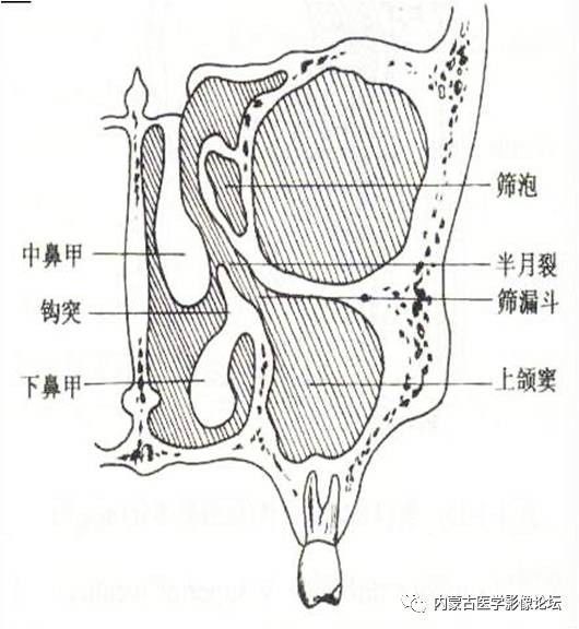 一文详述鼻和鼻窦的正常解剖及常见变异