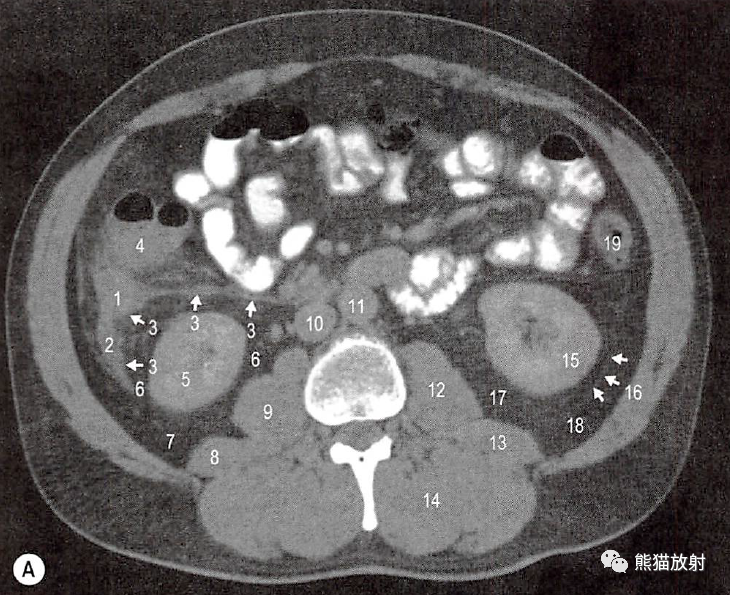 腹后壁和腹膜后间隙的解剖内附影像学图谱