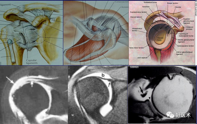 高清影像图解肩关节从影像解剖到影像诊断