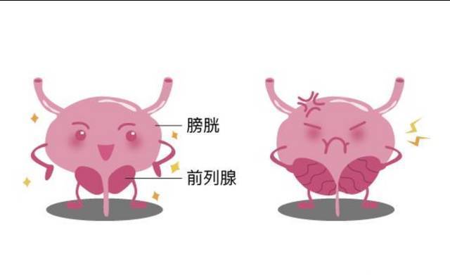 前列腺问题是中年男性的痛出现这几个征兆不能忽视