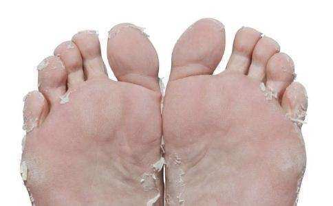 脚脱皮，脚痒，老中医土方7天除脚气，不复发！，天天说养生文章