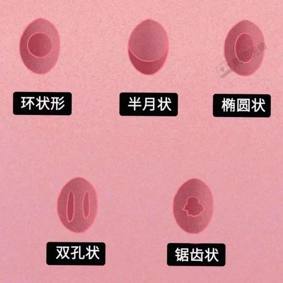 处女膜 