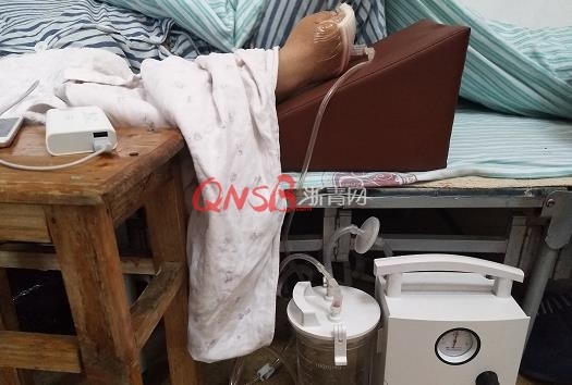 萧山一大姐用手挡了下门 被夹断两根手指