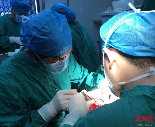 15岁男孩后脑长出大山包 长沙医生排除颅内