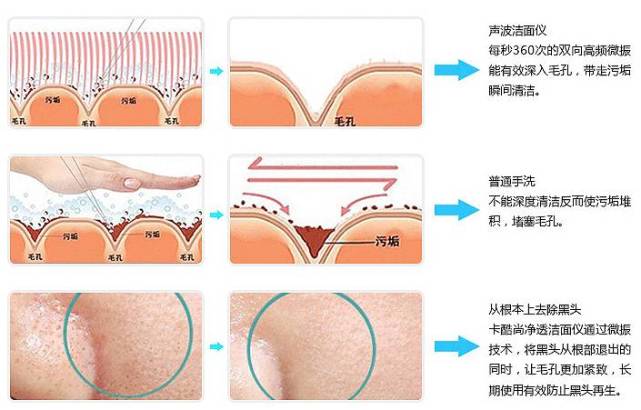 同样是美容仪器，你用着没效果别人用完像做了微整？