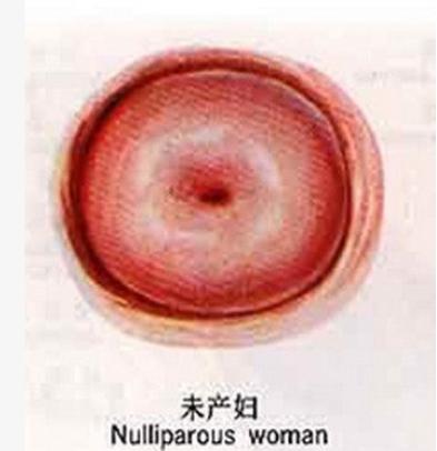 后素颜出席活动,身体这一部位足以看出她生过