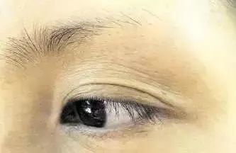 眉毛短缺,部分无毛者眉间过窄甚至相交者5,半截眉毛与贵人缘分浅,得不