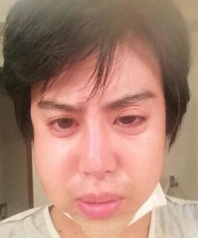 日本男子靠脸吃饭,一年整容50次成为"真蛇精"