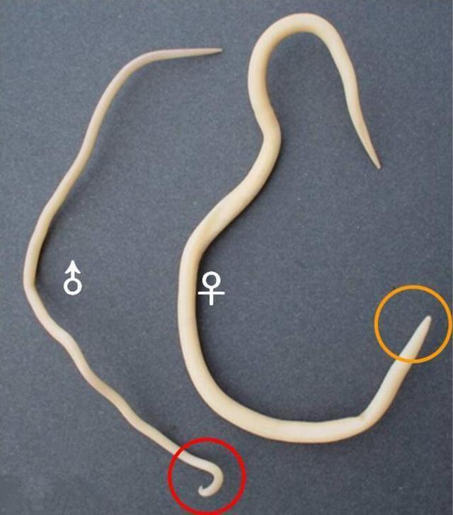 孩子这6个症状,就是肚子长了蛔虫