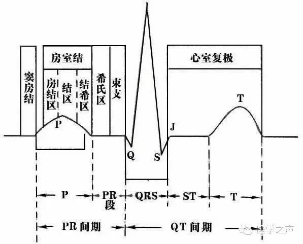 房早与室早;6. 心房扑动  7.房颤,8. 室速  9. 室