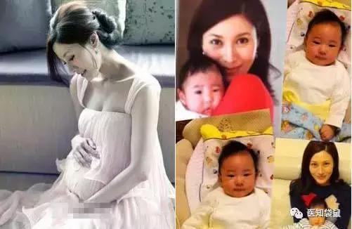 顺产和剖腹产到底哪个好?为什么明星生孩子都
