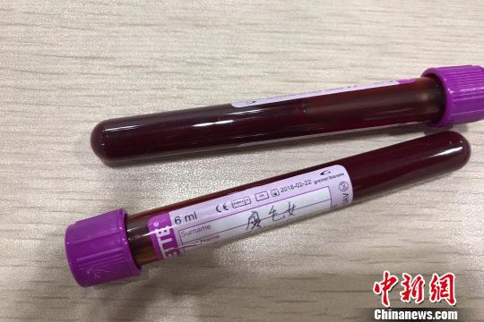 大陆女带百支孕妇血液制品前往香港 欲作胎儿性别鉴定被查（图） - 2