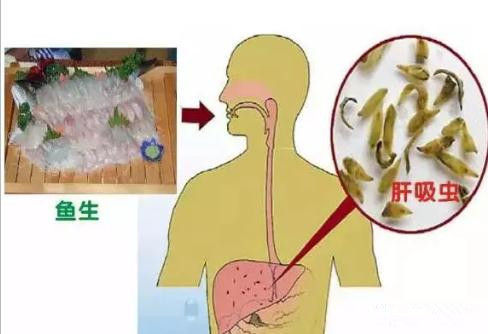火炬区超两成人群感染肝吸虫
