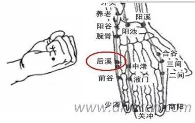 3.背痛内环腰印上颈部疼痛,针刺中渚肩部疼痛,针