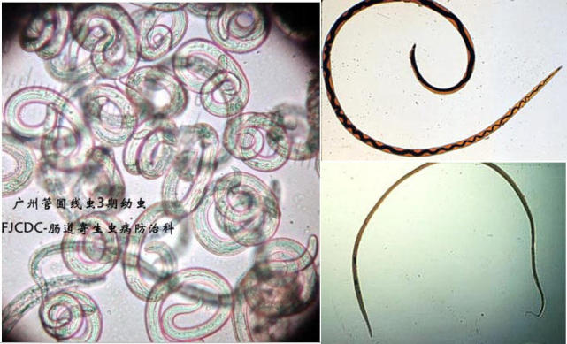 广州管圆线虫图