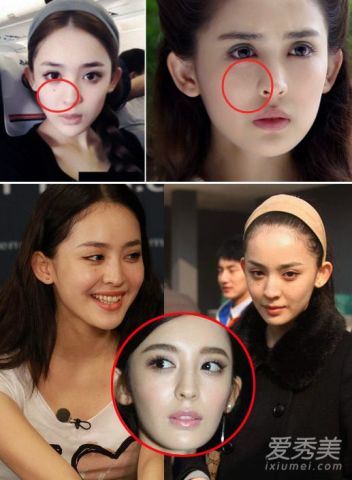 技术分析娜扎整容了吗?最近话题竟是娜扎颜值
