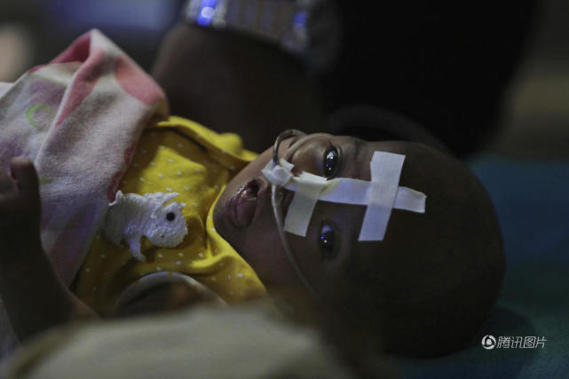 印度医院85名儿童疑窒息死亡 医生是帮凶