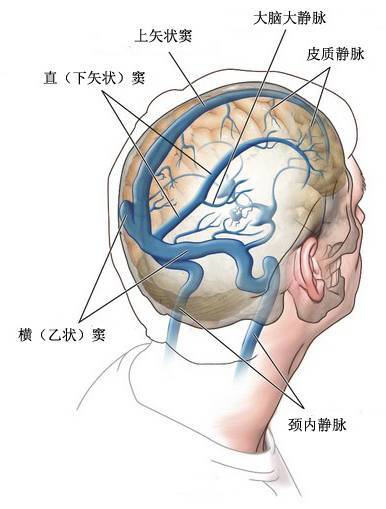 图17  大脑浅动脉