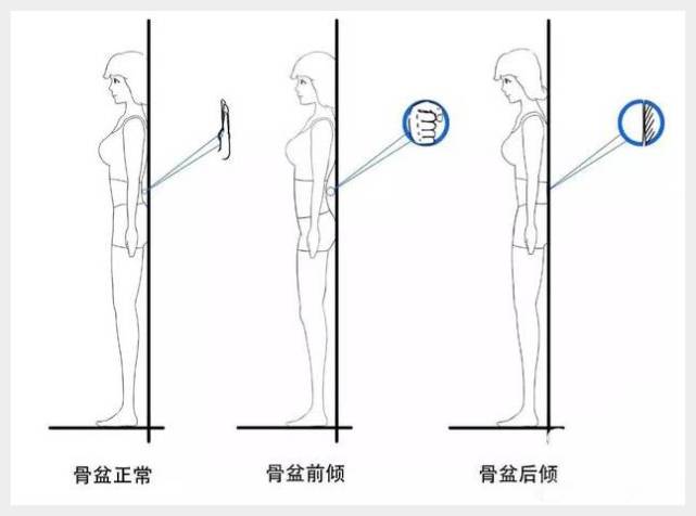 至于怎么区分,回家站墙根的时候,看看腰与墙的距离就知道了.