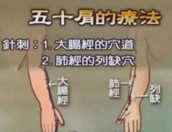 头项如有病,后溪并风池;环跳与阳陵,膝前兼胸肋;三百六十穴,不