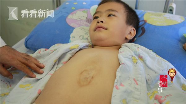 心脏在肚子上跳!上海援疆医生将7岁孩童变身"钢铁侠"_新闻_腾讯网