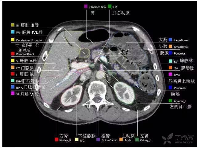 【收藏】全腹部高清ct图谱,淋巴结彩色图谱,血管解剖图谱大汇总!