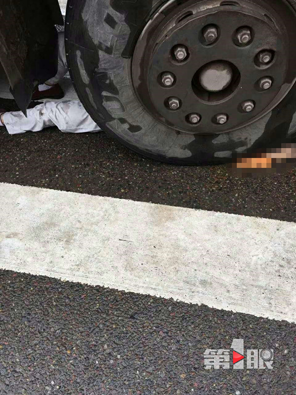 重庆一男子遭重型货车碾压 或被截肢