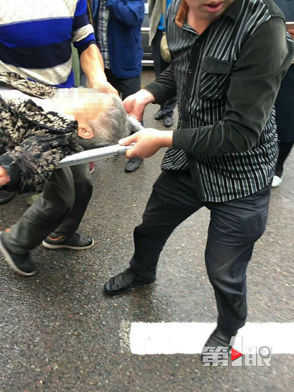 重庆一男子遭重型货车碾压 或被截肢