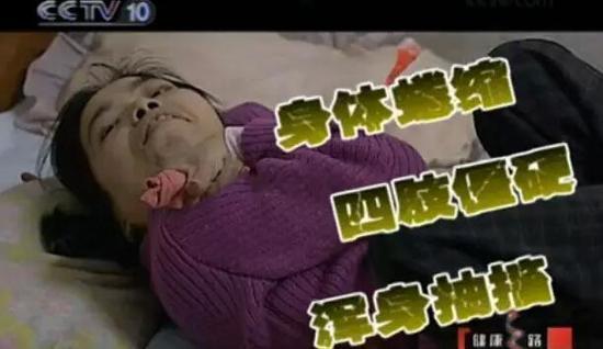 清明时节千万别吃到霉变甘蔗 它比毒蛇还毒