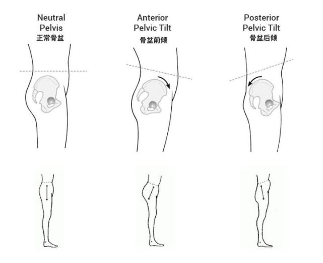 而如果大腿,臀部无法贴靠墙壁,髋部向前推,则可能是骨盆后倾.