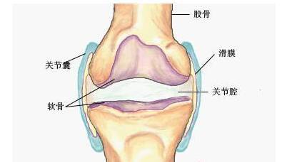 膝关节滑膜炎|膝关节|膝关节骨关节炎