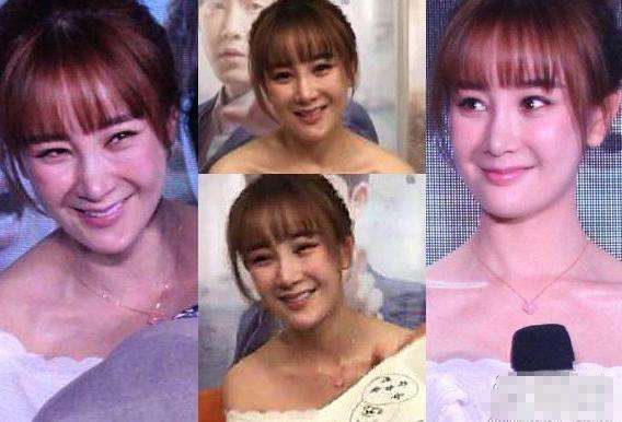 张檬耿直承认整容失败,取出假体后首次现身,网