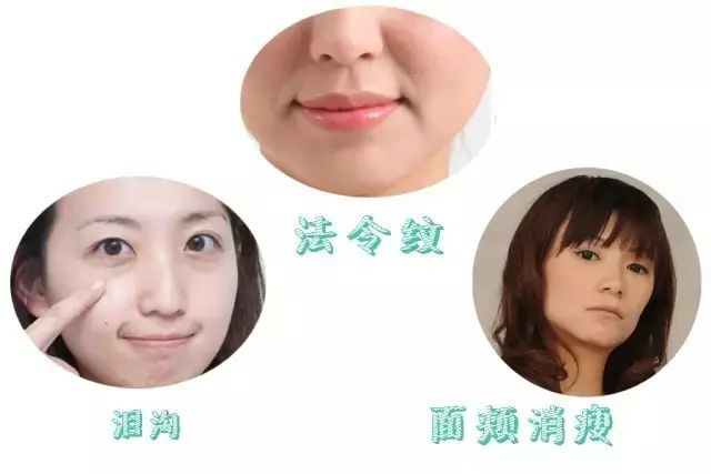 看,玻尿酸是这样把她们送上少女宝座的!