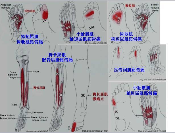 hallucis足部骨间肌(interossei of foot)比目鱼肌(soleus)拇收肌