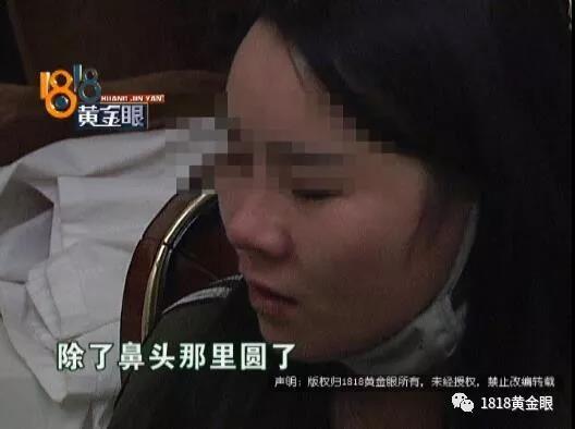 女子花十万整容 要像BABY和热巴