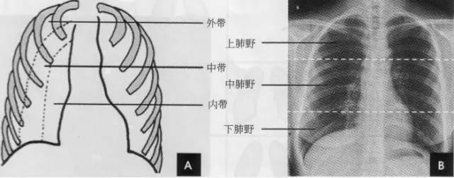 临床干货详细的胸部x线解剖最基础最实用