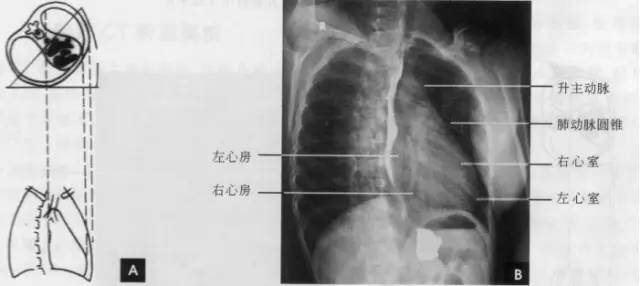 (三)左前斜位从后前位向右旋转约60.得到左前斜位(又称第二斜位).