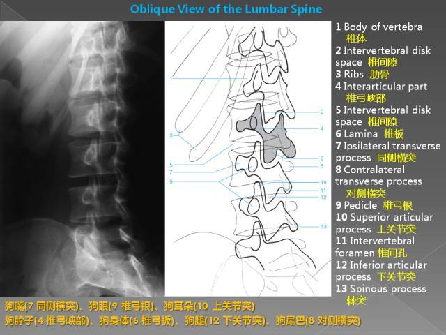 详细的腰椎x线解剖 解读