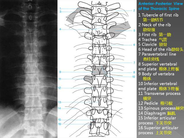 详细的腰椎x线解剖 解读