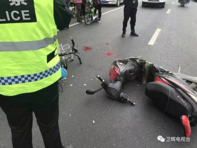 卫辉俩头部骑电动车被撞致一人女生大量出血罩c女孩初中图片