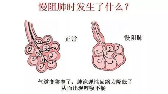 四川人健康報告：全省成年男性平均身高163.5cm