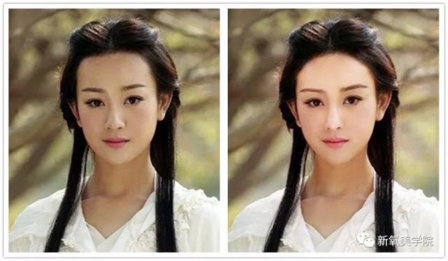 曾经被认为整形失败的张檬这是修复好了吗?还