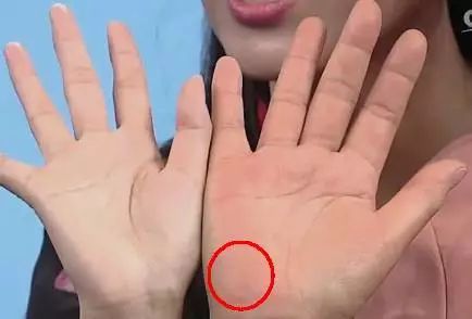 手是健康的镜子10种常见病从手上就能看出来