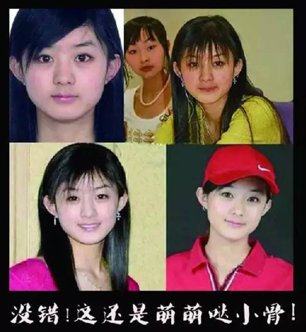 赵丽颖:十年微整形路