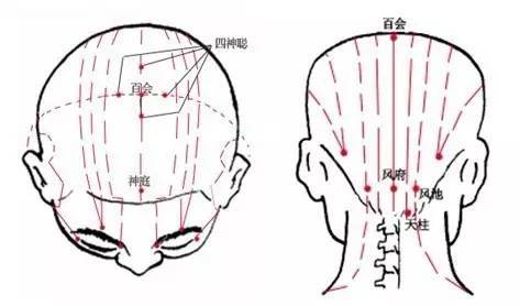 百会及四神聪,再刮头维至风池,重刮头维,风池,然后点按太阳穴.2.