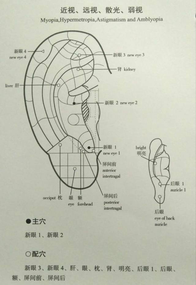 远视,散光,弱视配穴:三焦,肾,脾,肺,胃,艇中,肝,心,屏尖,肾上腺主穴