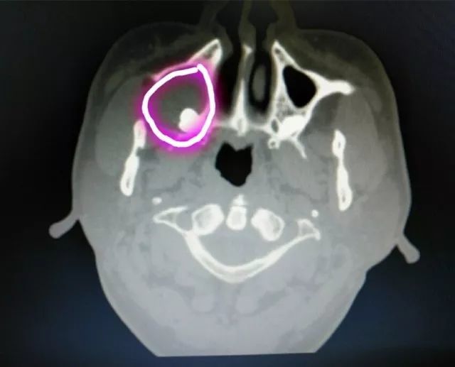 娄底男子53岁逆生长!可惜是牙齿不是容颜