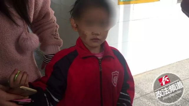 丧心病狂!长沙6岁卡通遭亲生女孩虐打头发掉女生头像a卡通母亲图片