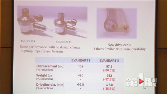 “重庆造”人工辅助心脏来啦！填补国内技术空白